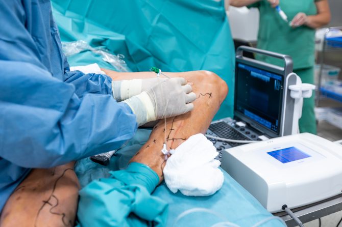 Leading Varicose Veins Specialist in London – Dr. Omar Abu-Bakr